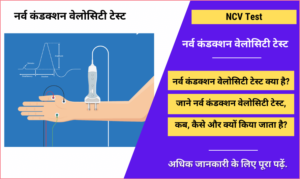 Nerve Conduction Velocity Ncv Test In Hindi