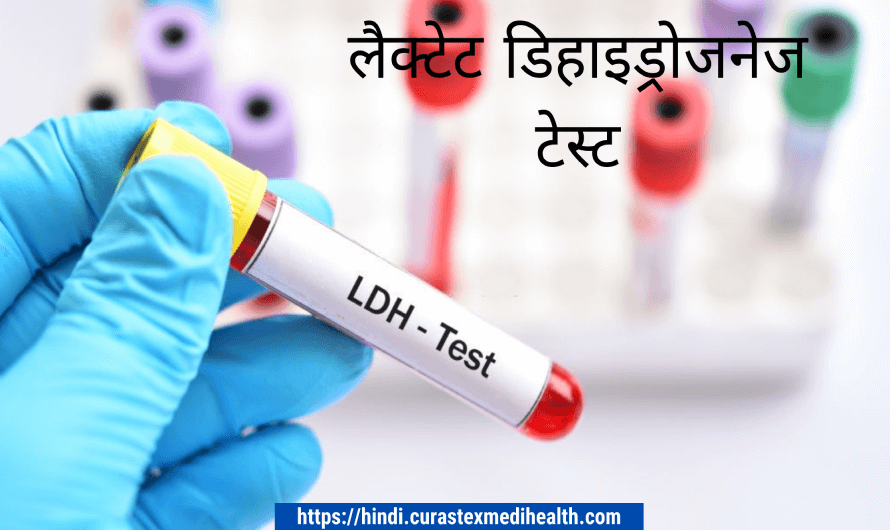 क्यों लैक्टेट डिहाइड्रोजनेज टेस्ट Lactate Dehydrogenase Test (LDH)  के तरफ  ध्यान देना चहिये?