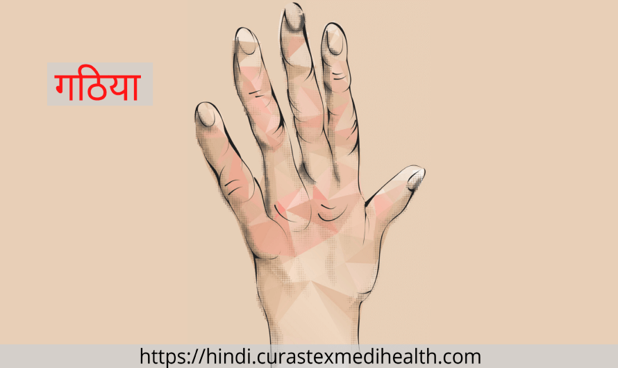 Arthritis in Hindi
