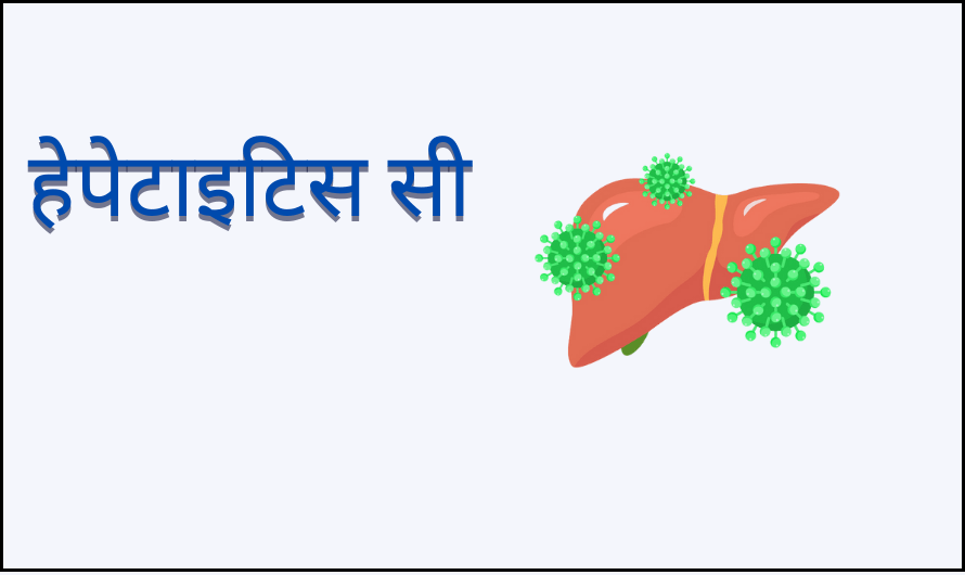 हेपेटाइटस सी | Hepatitis C in Hindi