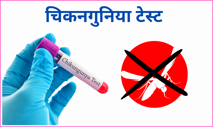 चिकनगुनिया टेस्ट – Chikungunya Test in Hindi