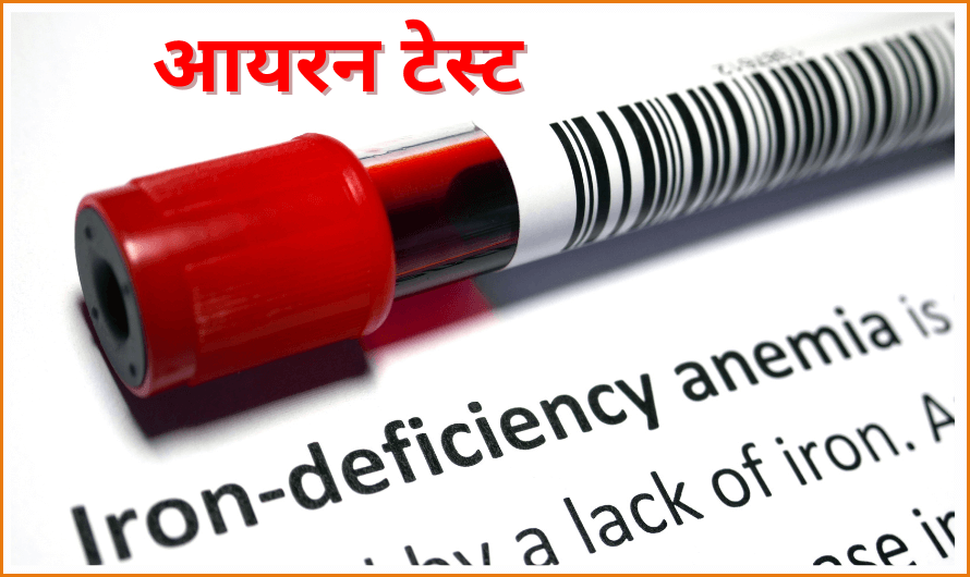 Iron test in Hindi