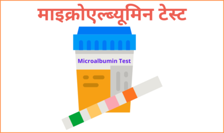 Image of container used for collection of urine for the purpose of microalbumin test.