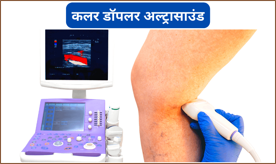 कलर डॉपलर अल्ट्रासाउंड – Color Doppler Ultrasound in Hindi
