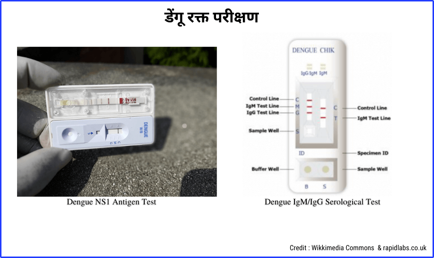 Dengue Fever blood test in Hindi