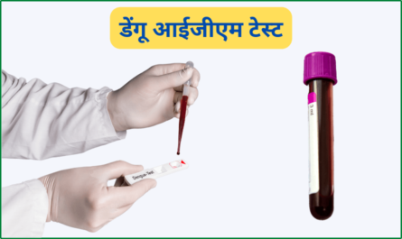 Dengue IgM Test in Hindi
