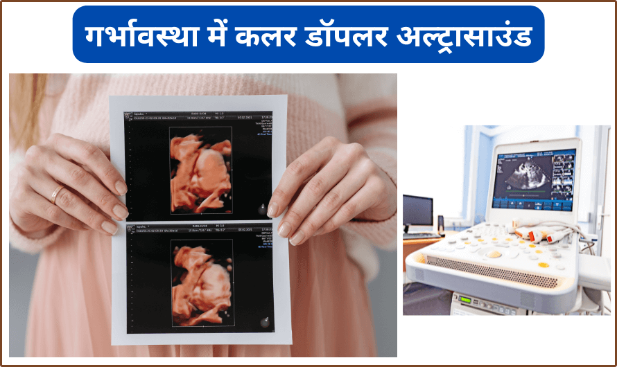 color doppler ultrasound in pregnancy in hindi
