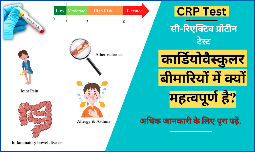 सी-रिएक्टिव प्रोटीन (सीआरपी) टेस्ट – CRP Test in Hindi