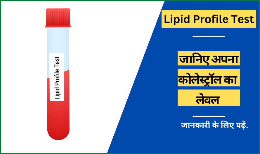 लिपिड प्रोफाइल टेस्ट – Lipid Profile Test in Hindi