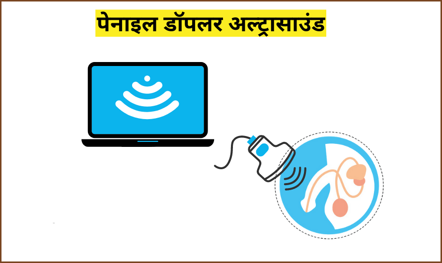 पेनाइल डॉपलर अल्ट्रासाउंड – Penile Doppler Ultrasound in Hindi
