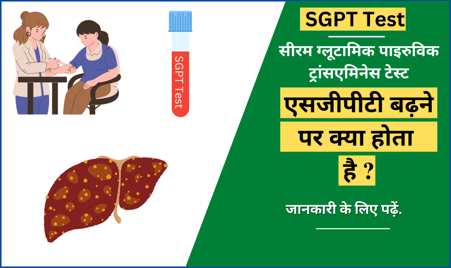 sgpt-sgpt-test-in-hindi-sgpt-kya-hai-sgpt-test-cost