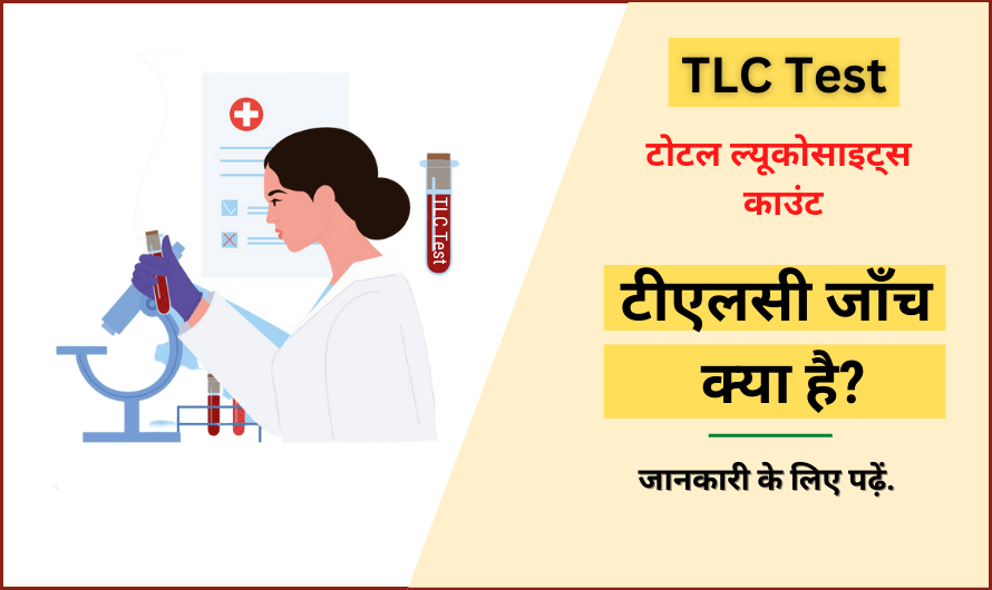 टोटल ल्यूकोसाइट्स काउंट – TLC test in Hindi