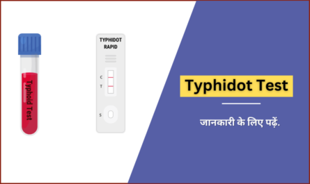 Typhidot Test in Hindi