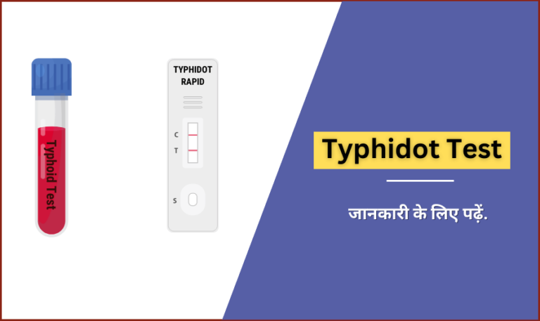 typhidot-test-in-hindi-procedure-test-price