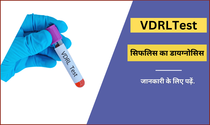 वीडीआरएल टेस्ट – VDRL Test in Hindi
