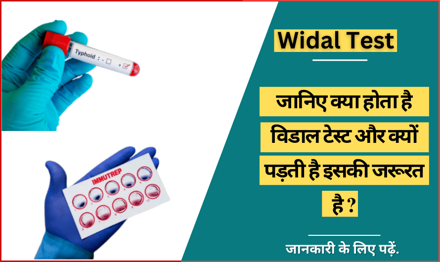 Widal test in Hindi