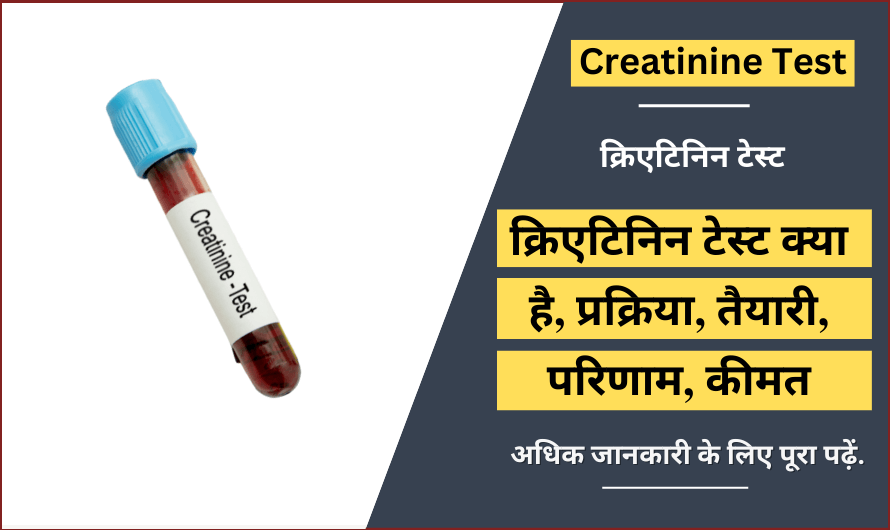 Creatinine Test in Hindi