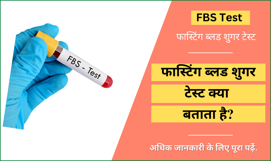 फास्टिंग ब्लड शुगर टेस्ट – Fasting Blood Sugar (FBS) Test in Hindi