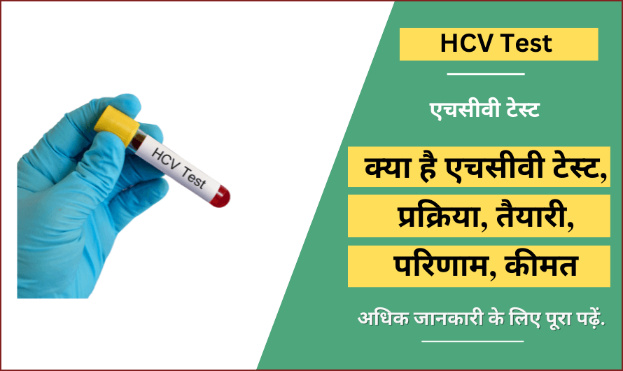 एचसीवी टेस्ट – HCV Test in Hindi