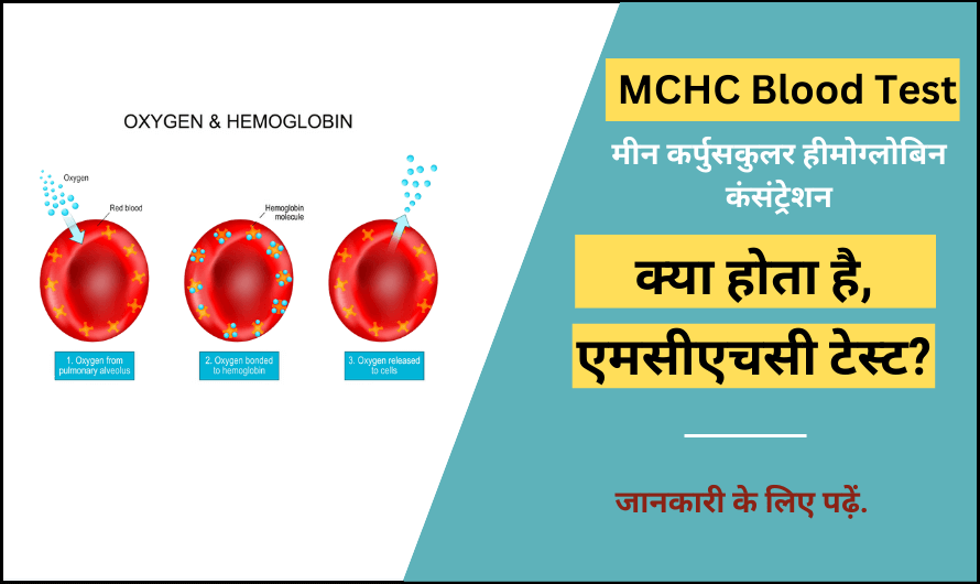 एमसीएचसी ब्लड टेस्ट – MCHC Blood Test  in Hindi