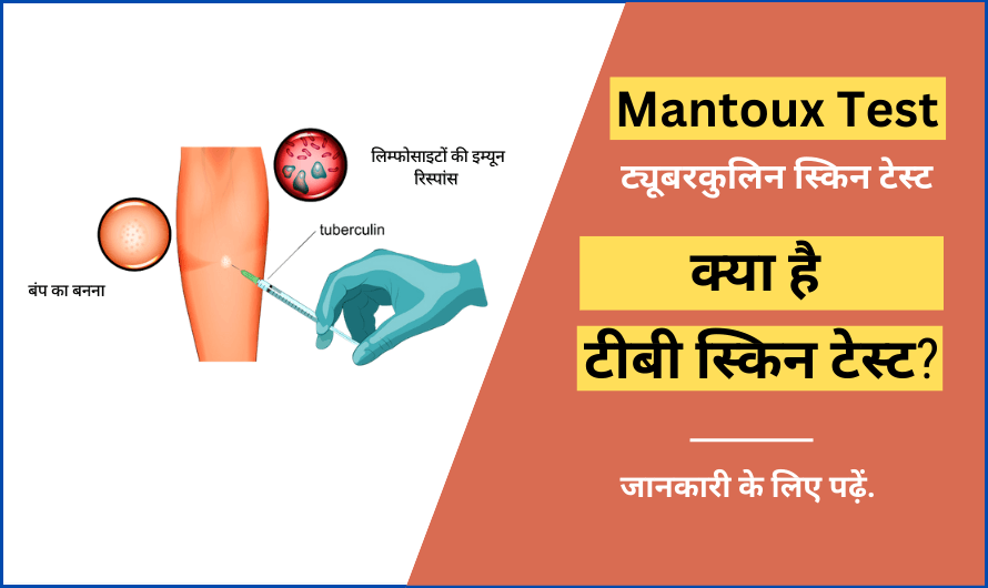 Mantoux test in Hindi