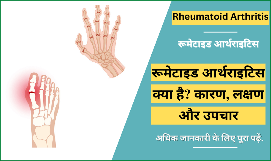rheumatoid arthritis in hindi
