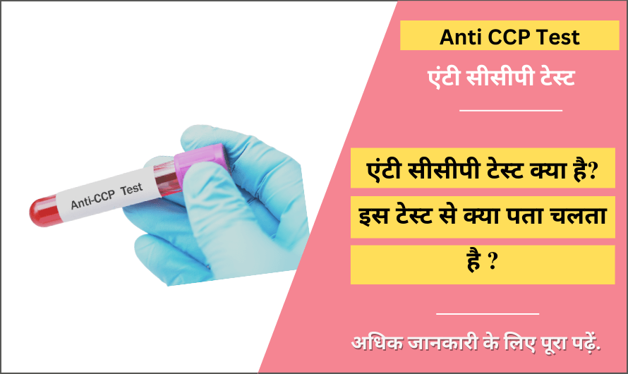 एंटी सीसीपी टेस्ट – Anti CCP Test in Hindi