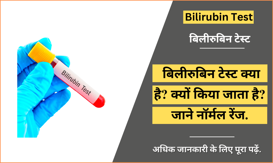 बिलीरुबिन टेस्ट – Bilirubin Test in Hindi