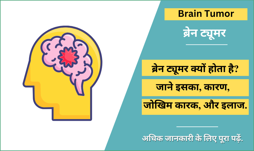 ब्रेन ट्यूमर – Brain Tumor in Hindi
