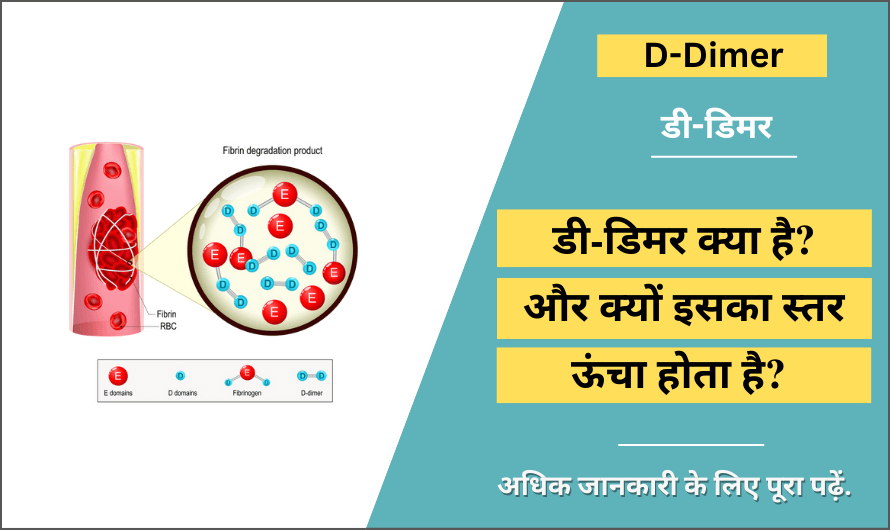 डी-डिमर – D-Dimer in Hindi
