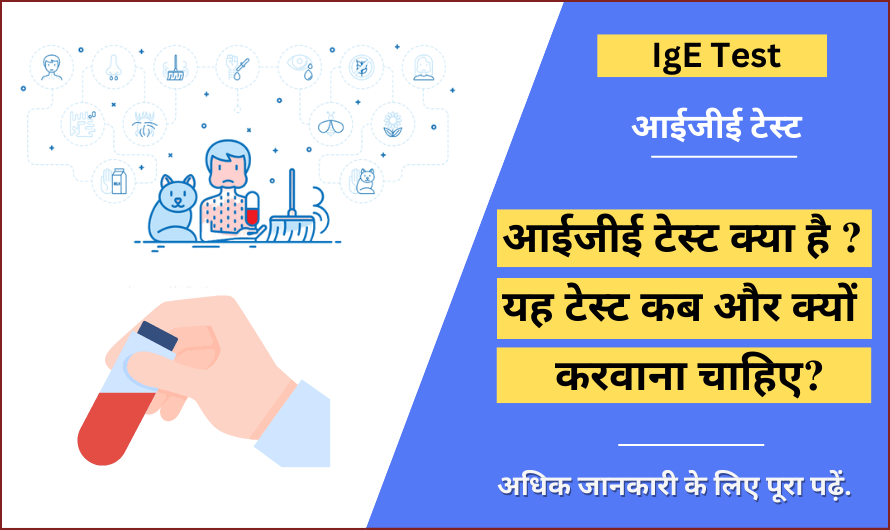 IgE test in hindi