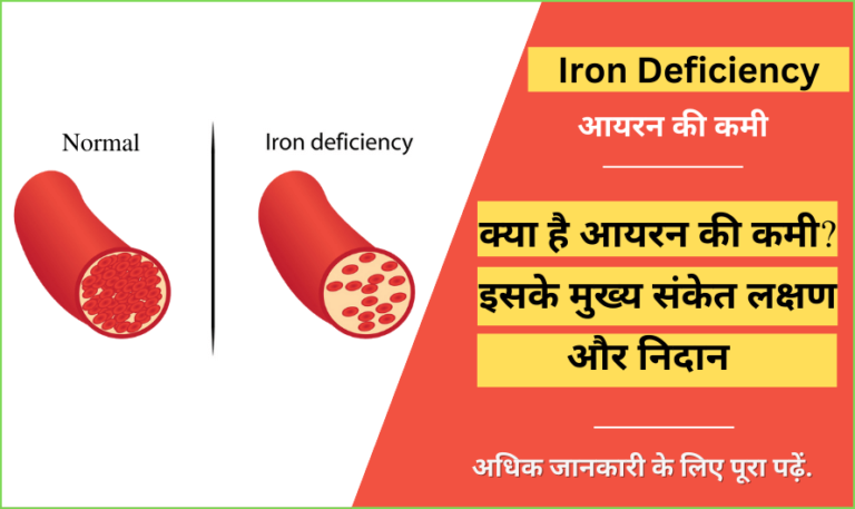 iron-deficiency-in-hindi-causes-treatment