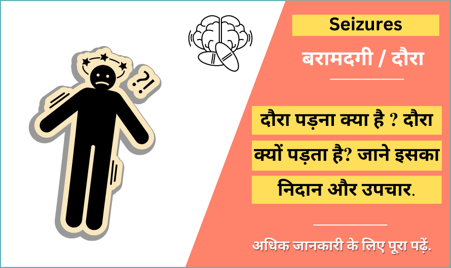 Seizures in Hindi