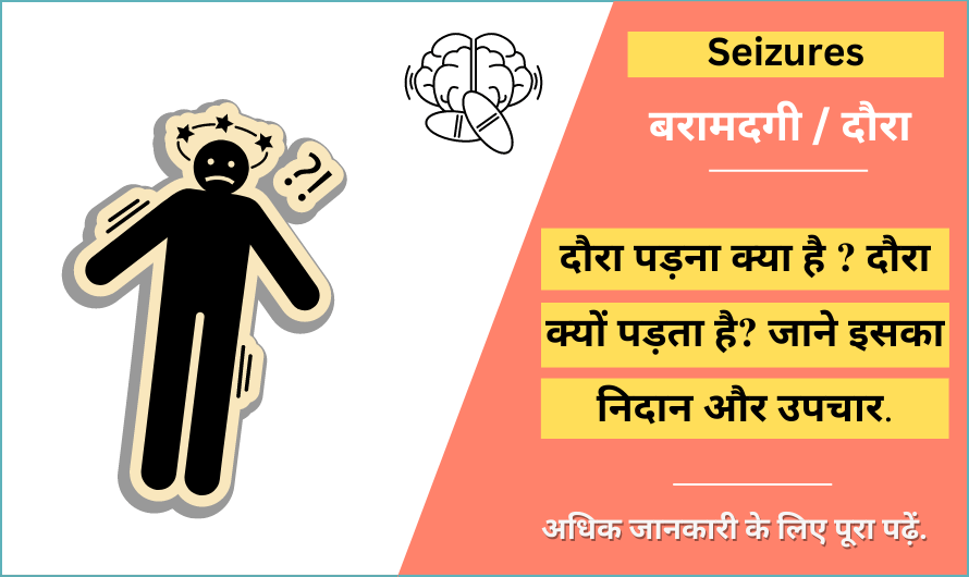 seizure-meaning-in-hindi-english-seizure-ka-matlab-kya-hota-hai