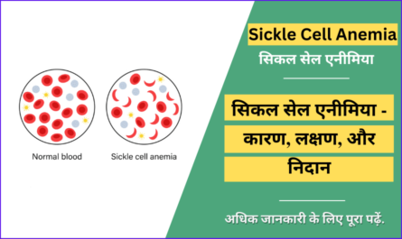 Sickle Cell Anemia in Hindi