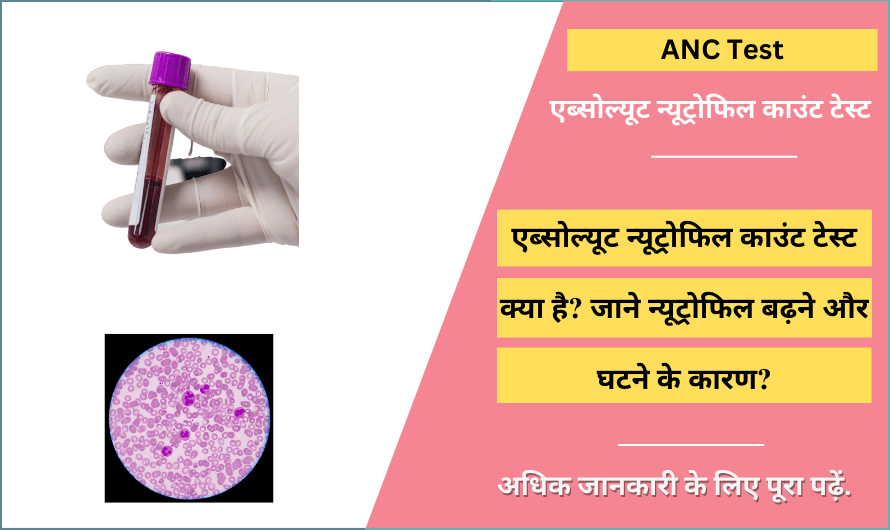 एब्सोल्यूट न्यूट्रोफिल काउंट – Absolute Neutrophil Count (ANC) Test in Hindi
