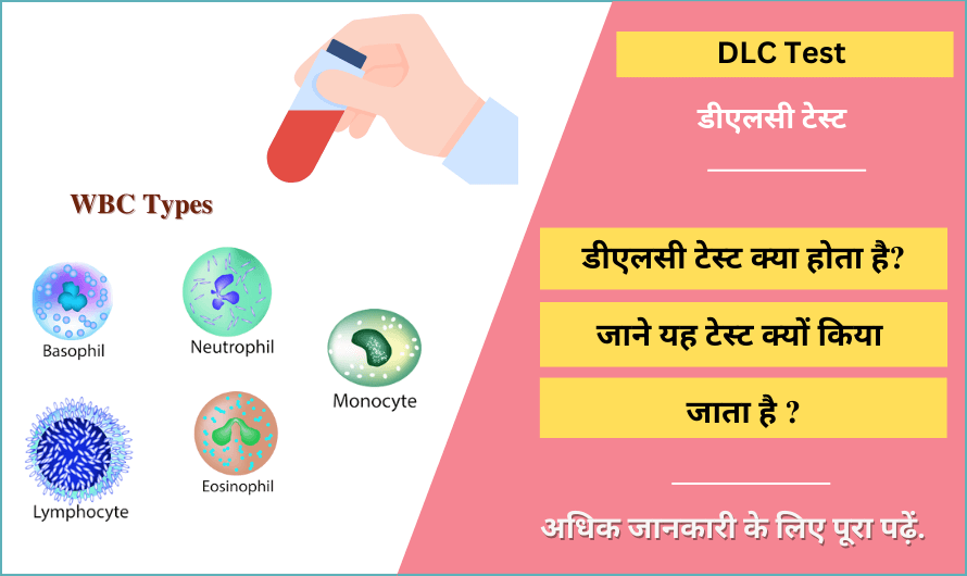 dlc-test-in-hindi-meaning-normal-range-test-price