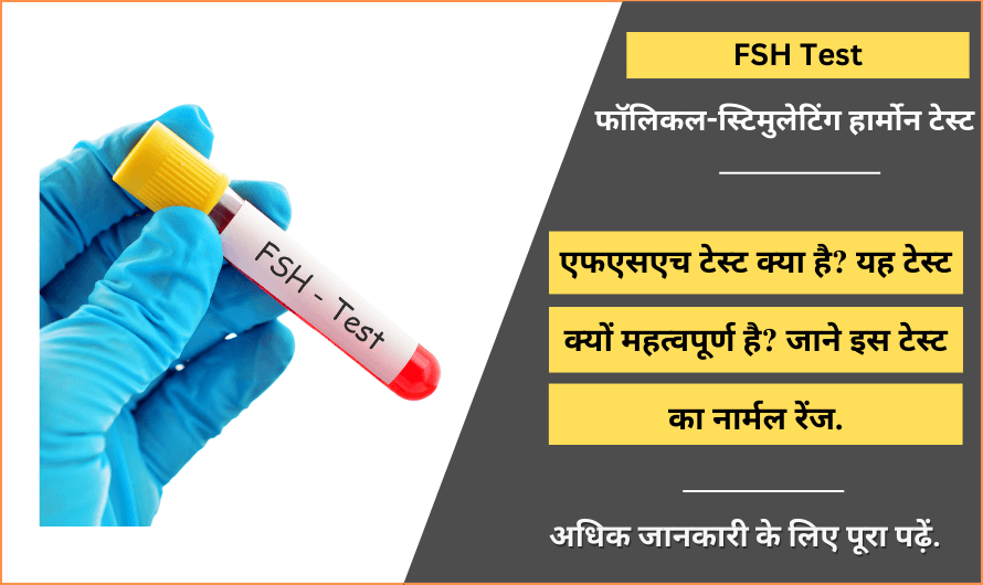 फॉलिकल-स्टिमुलेटिंग हार्मोन टेस्ट – Follicle-Stimulating Hormone (FSH) Test in Hindi