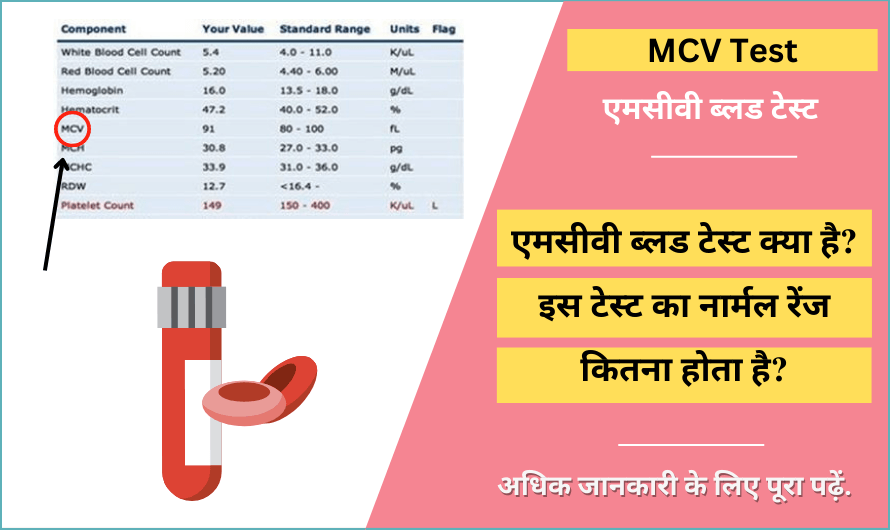 एमसीवी टेस्ट – MCV Test in Hindi