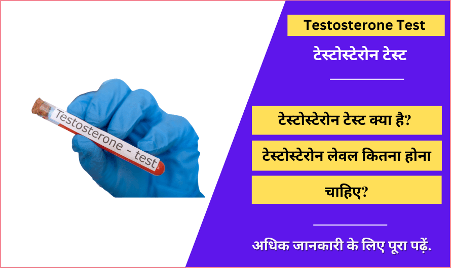 टेस्टोस्टेरोन टेस्ट – Testosterone Test in Hindi