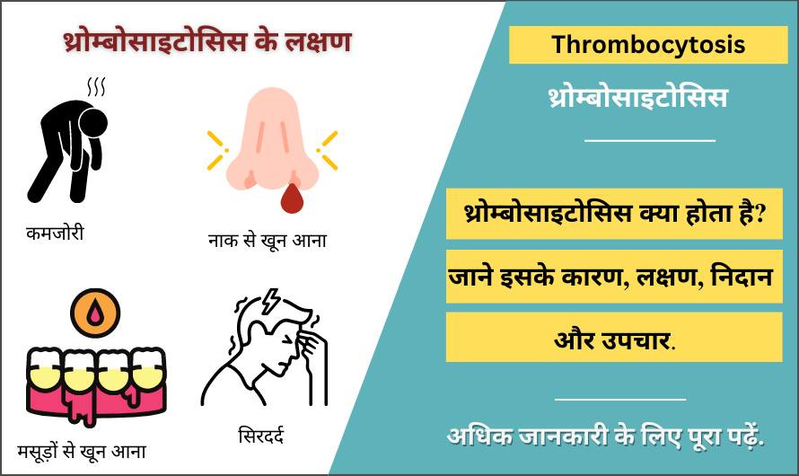 Thrombocytosis in Hindi