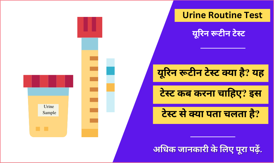 यूरिन रूटीन टेस्ट – Urine Routine Test in Hindi