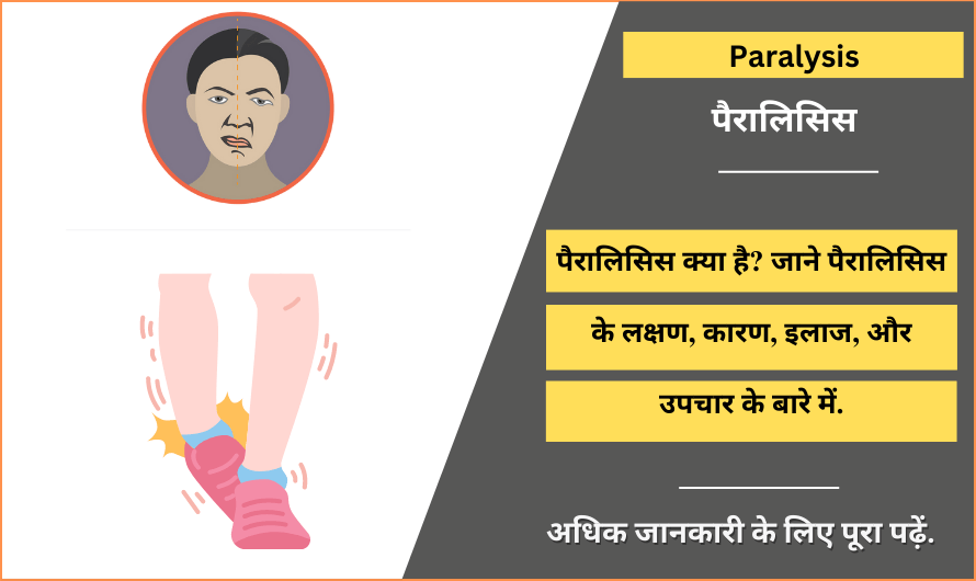 पैरालिसिस – Paralysis Meaning in Hindi