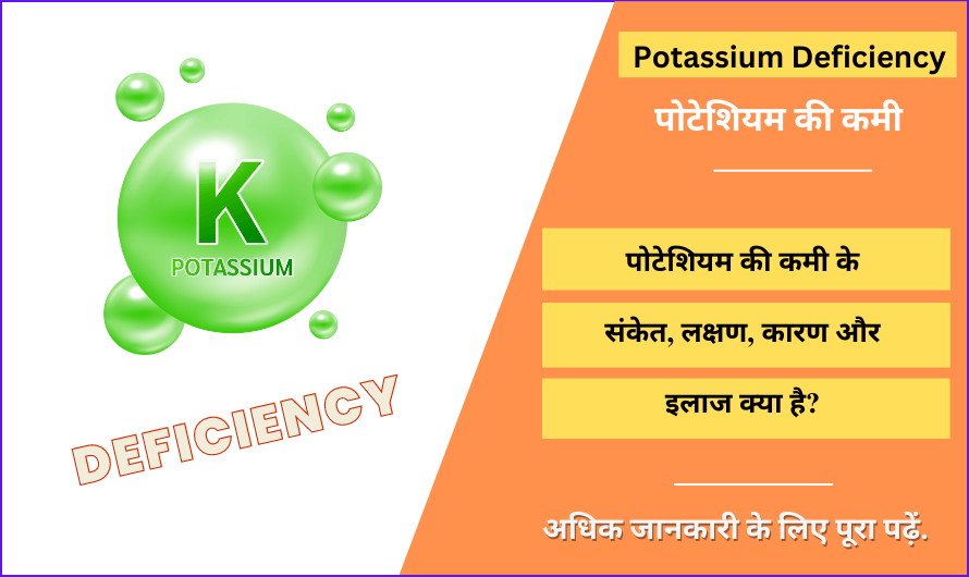 पोटेशियम की कमी – Potassium Deficiency in Hindi