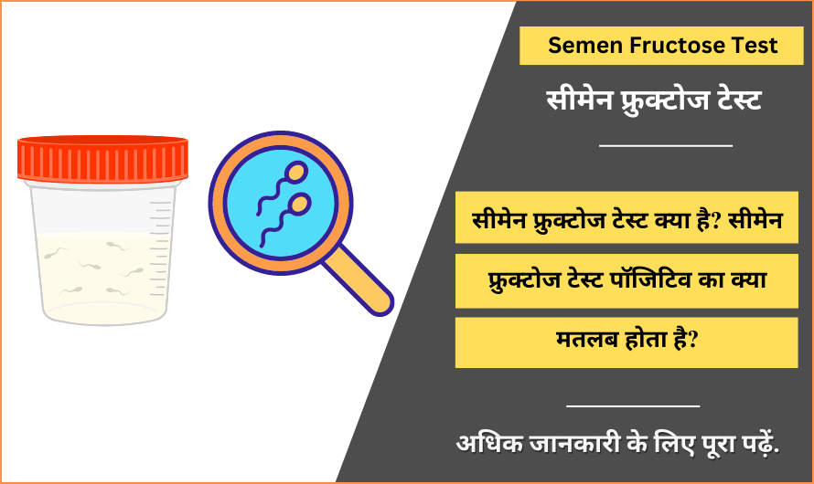 सीमेन फ्रुक्टोज टेस्ट – Semen Fructose Test in Hindi