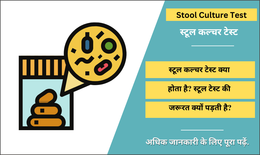 स्टूल कल्चर टेस्ट – Stool Culture Test in Hindi