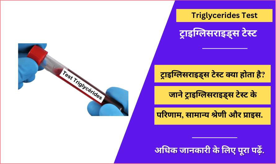 ट्राइग्लिसराइड्स टेस्ट – Triglycerides Test in Hindi
