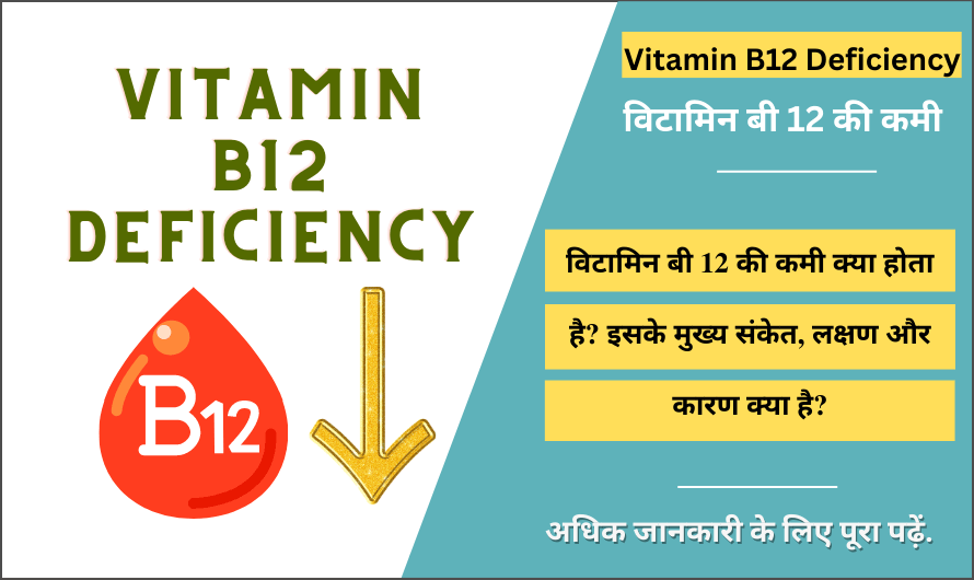 विटामिन बी 12 की कमी – Vitamin B12 Deficiency in Hindi