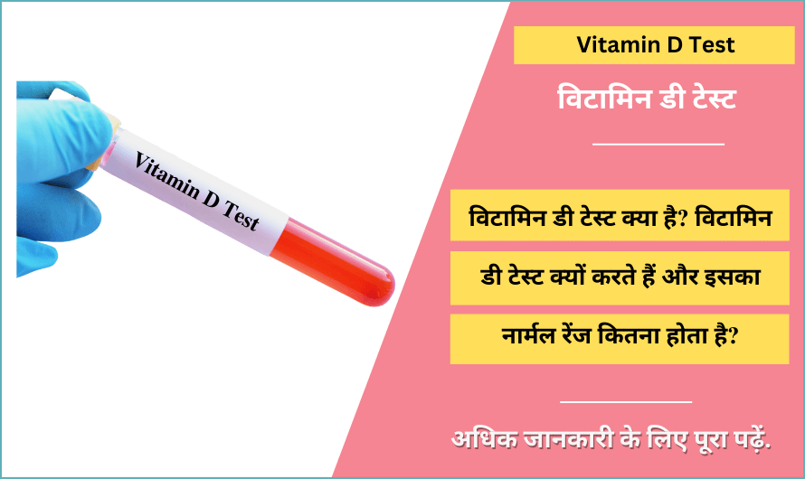 विटामिन डी टेस्ट – Vitamin D Test in Hindi
