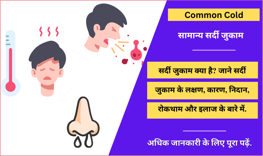 सामान्य सर्दी जुकाम Common Cold in Hindi, Meaning, Treatment